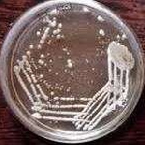 Lactobacillus acidophilus