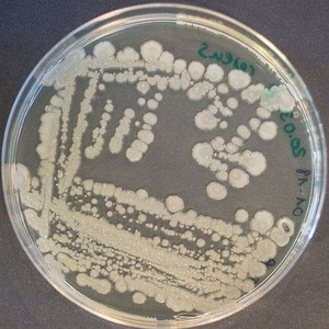 Bacillus cereus