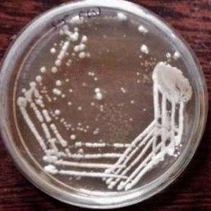 Lactobacillus casei