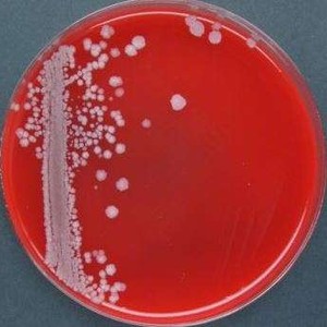 bacillus coagulans