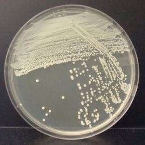 Escherichia coli