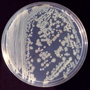 Enterobacter aerogenes