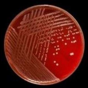 Staphylococcus epidermidis