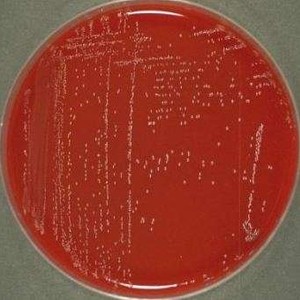 Lactococcus lactis
