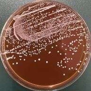 Lacto casei bacillus rhamnosus