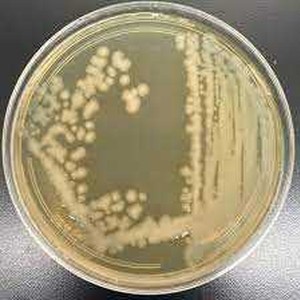 Salmonella Typhimurium