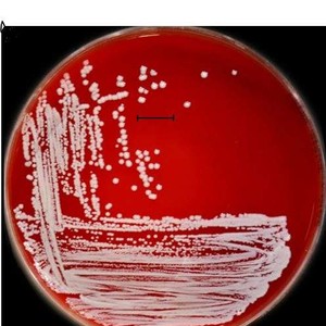 Staphylococcus saprophyticus