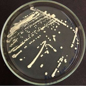 saccharomyces cerevisiae