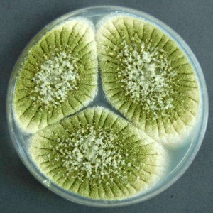 Aspergillus brasiliensis